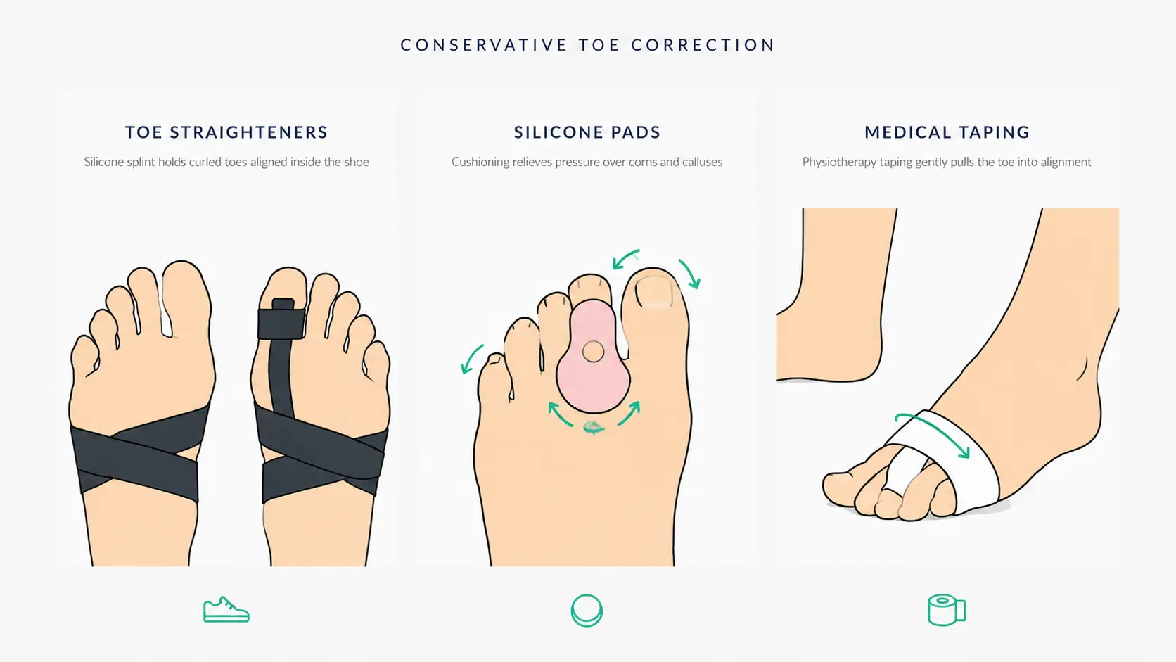 Hammer toe treatment showing toe splints, silicone pads, and medical taping reducing pain and improving toe alignment.