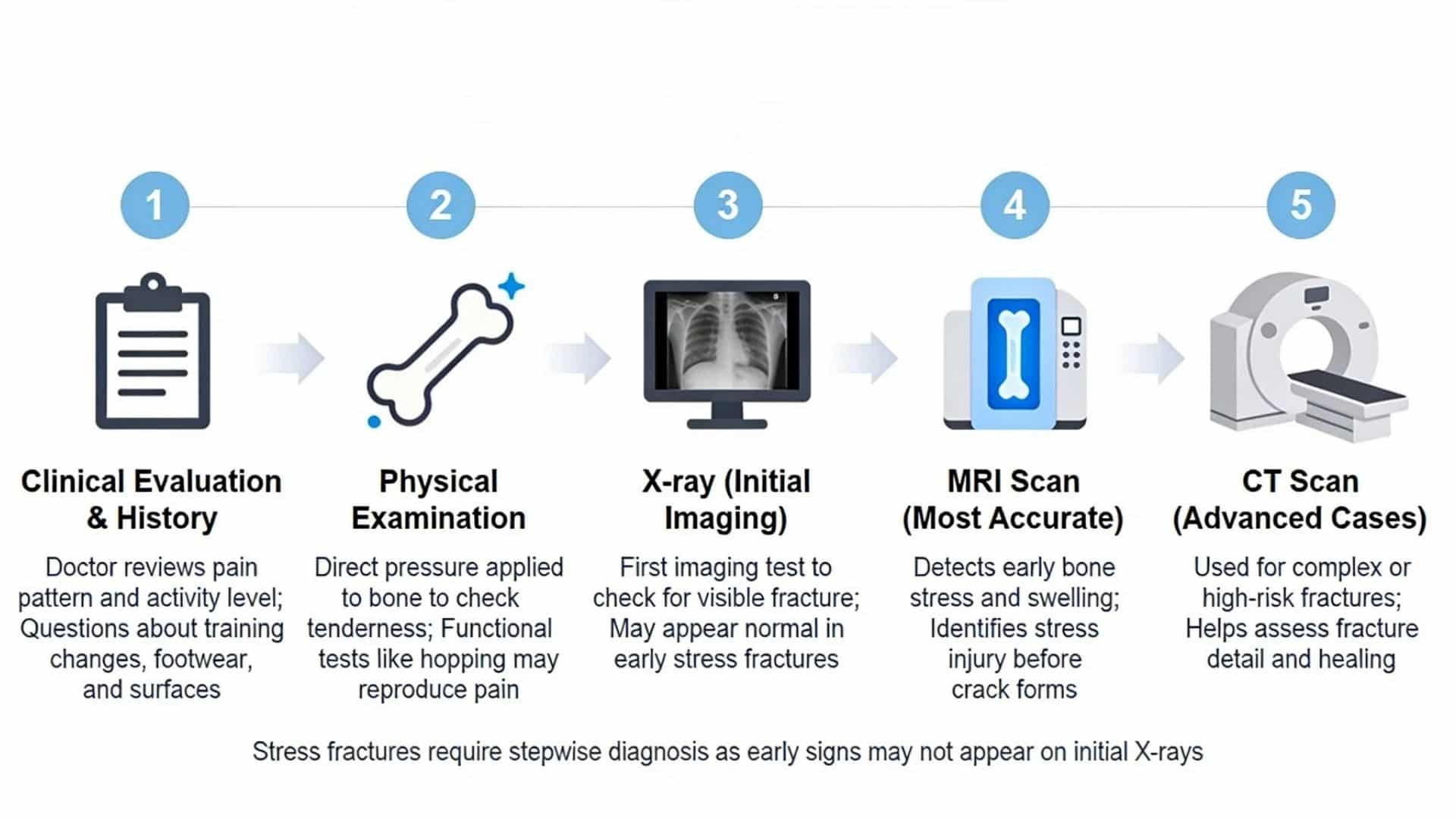Infographic showing step-by-step diagnosis of stress fractures using exam, X-ray, MRI, and CT scan.