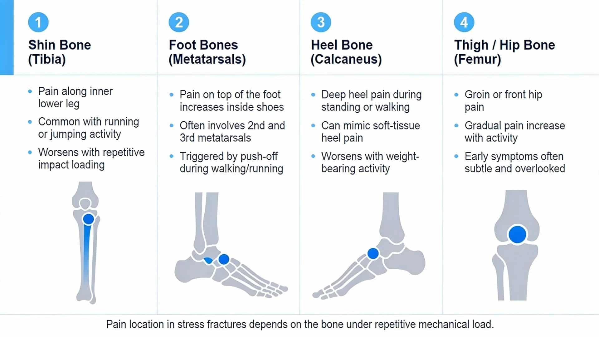 Infographic showing stress fracture symptoms by location in shin, foot, heel, and thigh bones.