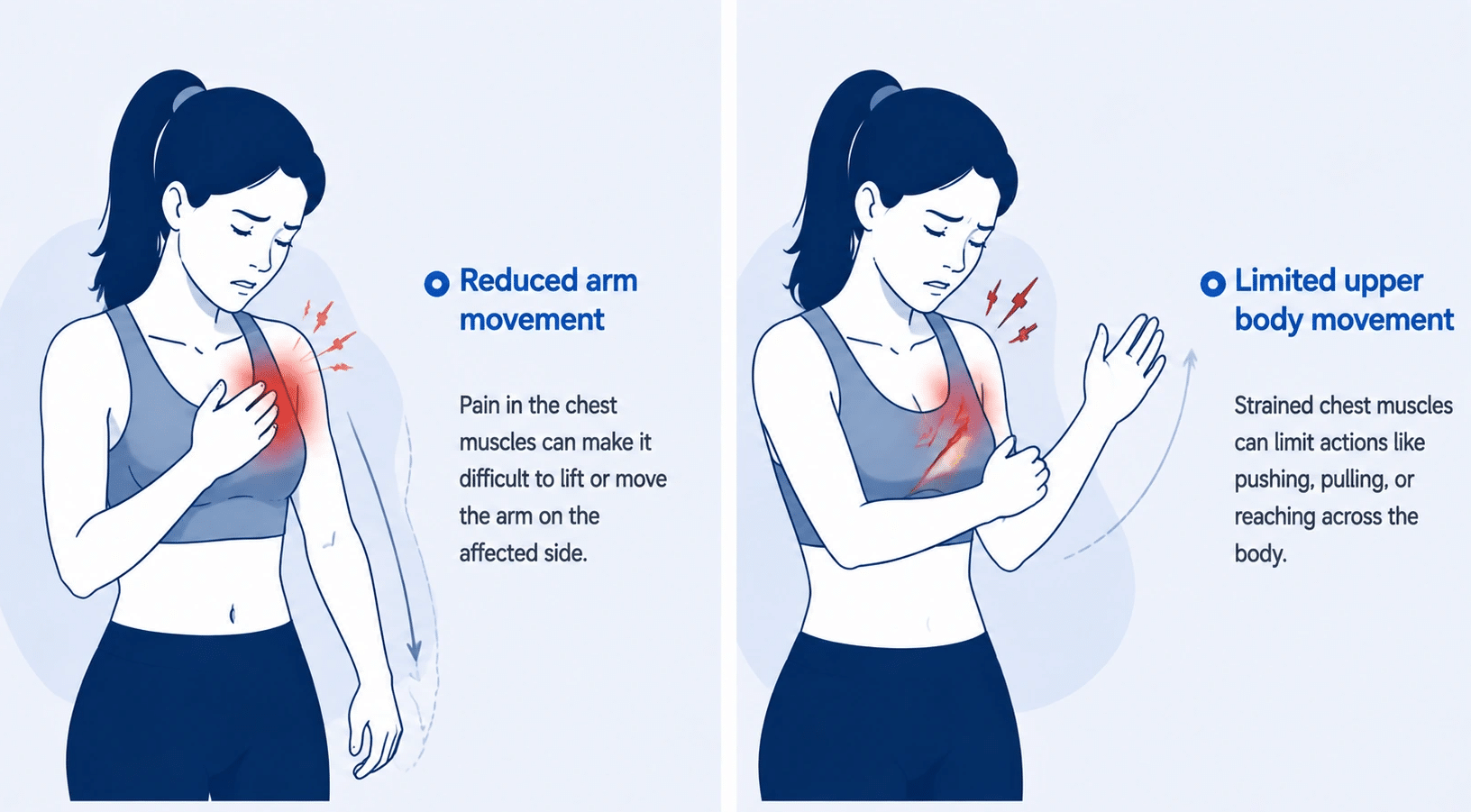 Medical illustration showing limited arm and upper body movement caused by chest muscle pain and strain during daily activities.