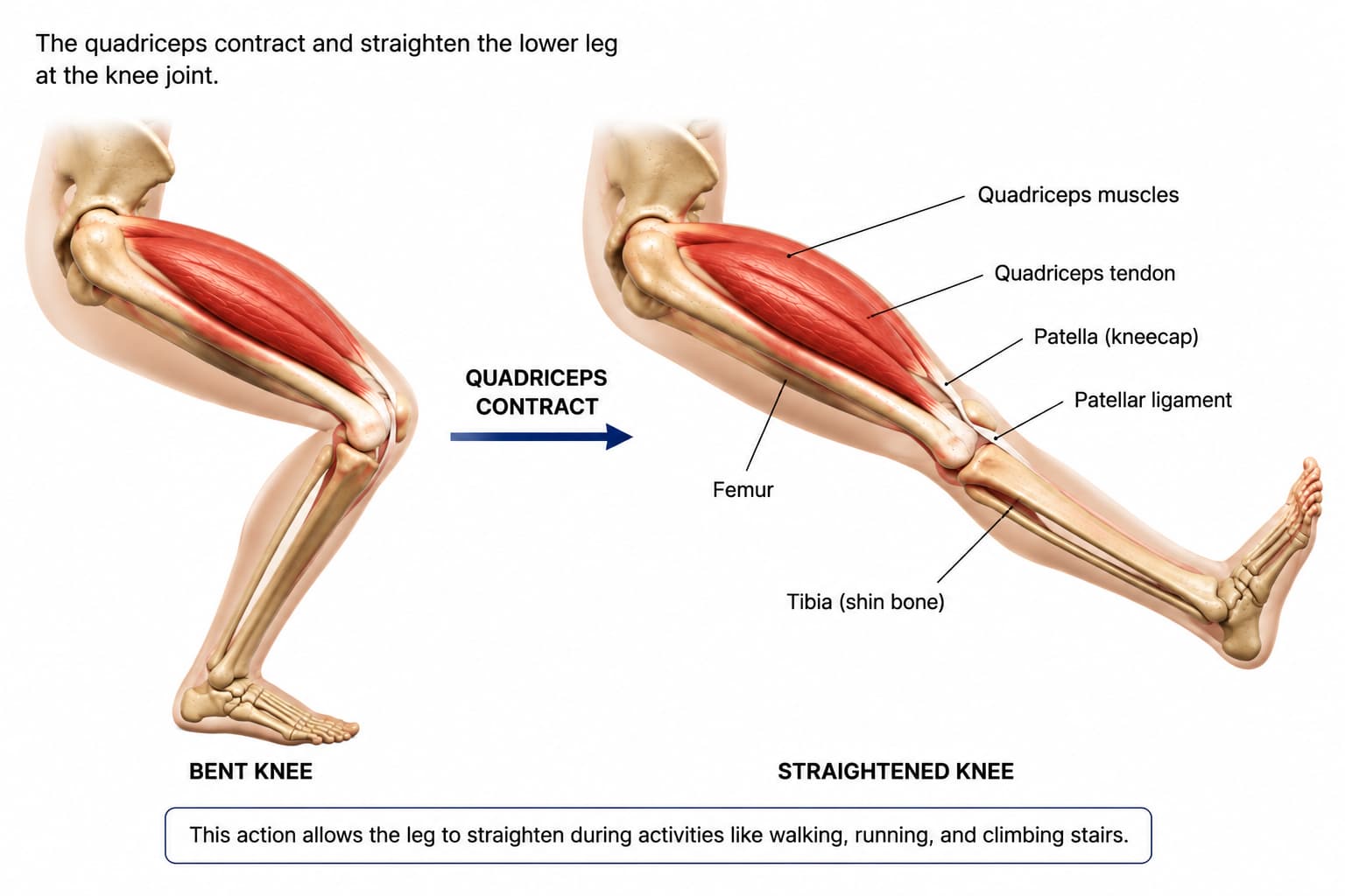 Medical illustration showing quadriceps contraction straightening the knee from a bent to extended position