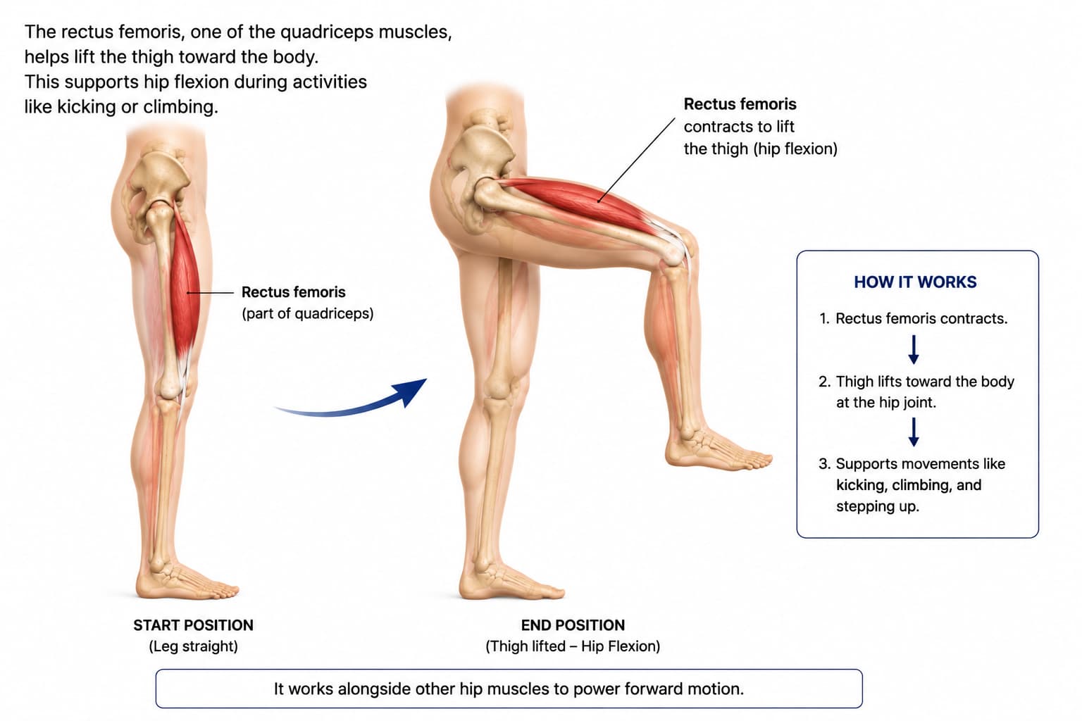 Medical illustration showing the rectus femoris lifting the thigh during hip flexion.